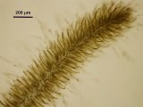 Dettaglio della porzione apicale